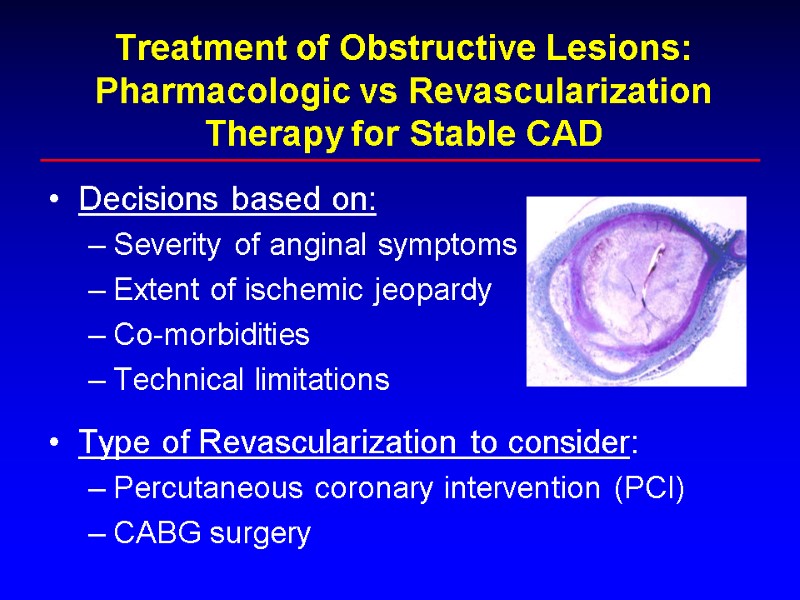 Treatment of Obstructive Lesions: Pharmacologic vs Revascularization Therapy for Stable CAD Decisions based on: